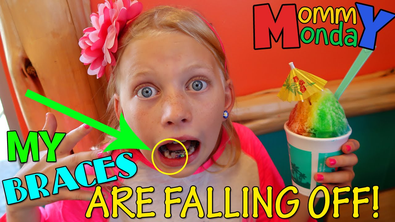 MY BRACES ARE FALLING OFF! || Mommy Monday