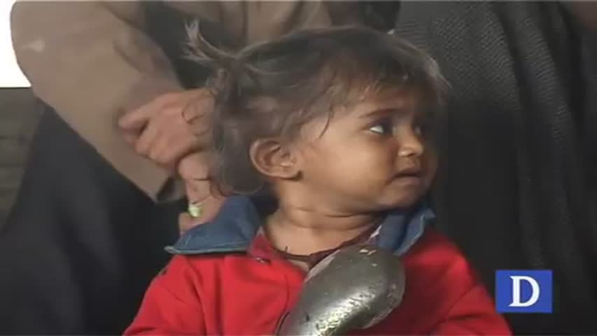 Nutrition situation in Pakistan for children under two is dire: UNICEF