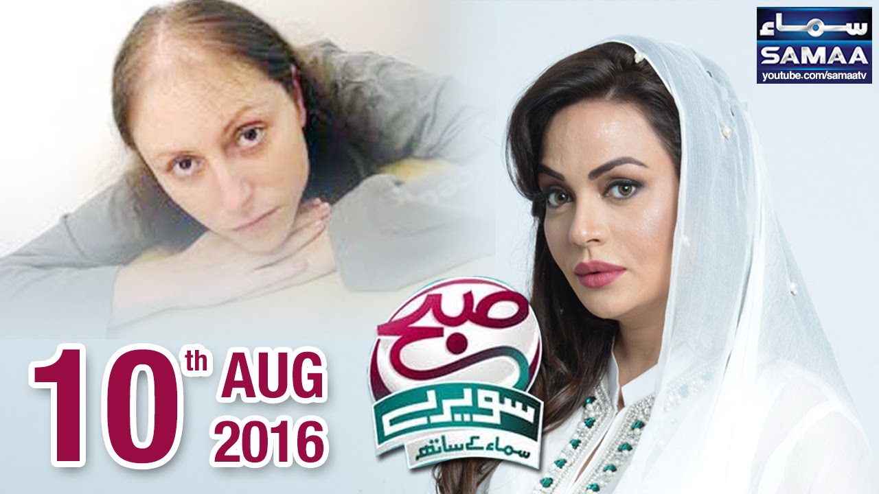 Ganjpan Ka Ilaj | Subah Saverey Samaa Kay Saath – 10 Aug 2016
