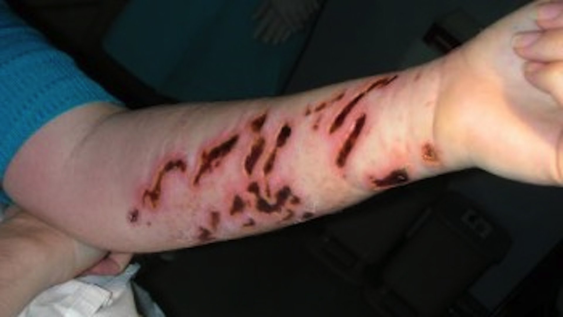 Encounters with 6 Deadly Sea Creatures