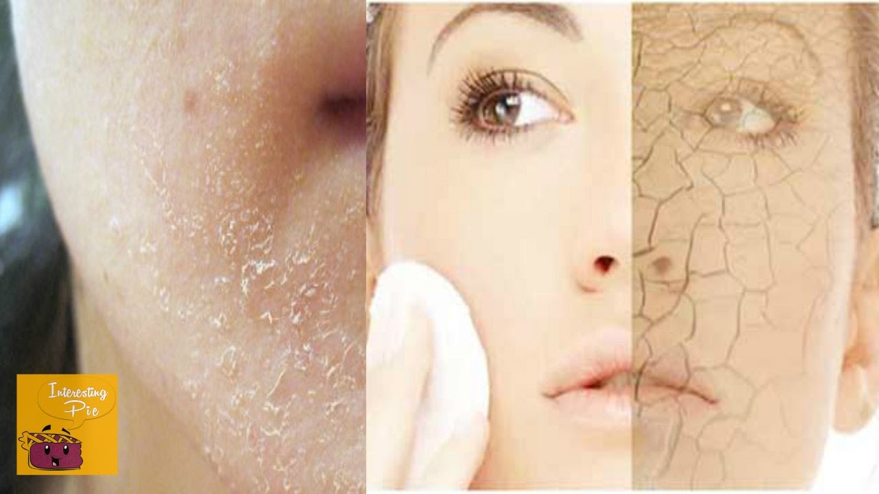 Dry Dull Skin to Smooth Glowing Skin | Remedy for Dry Flaky Skin in Winters