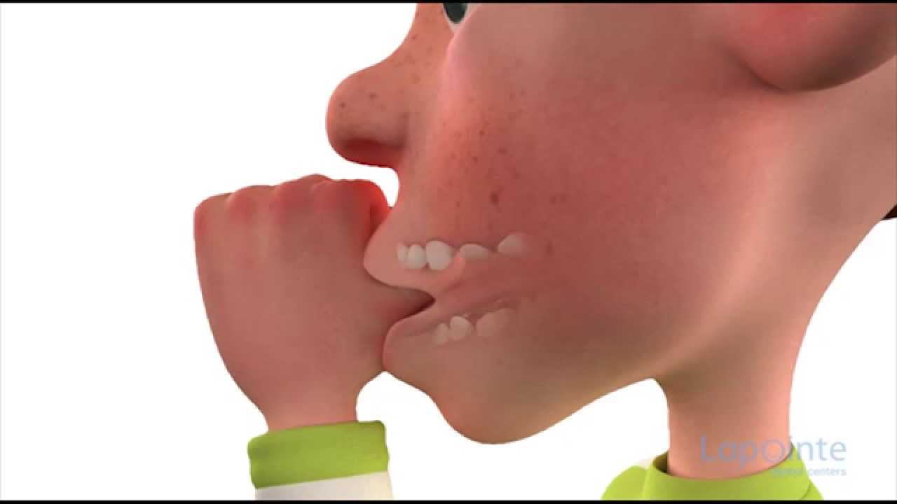 Thumb sucking, a bad habit (kids’ edition)  - Lapointe dental centres