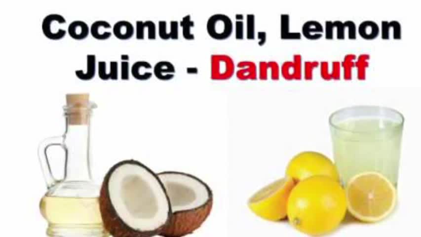 2 Home Remedies For Remove Dandruff By Sehar Syed