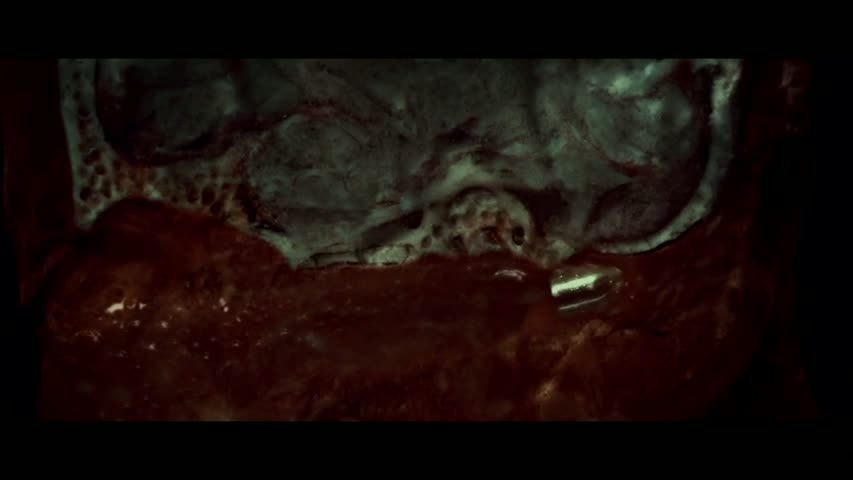 Hannibal - Season 3 Episode 4 - Aperitivo