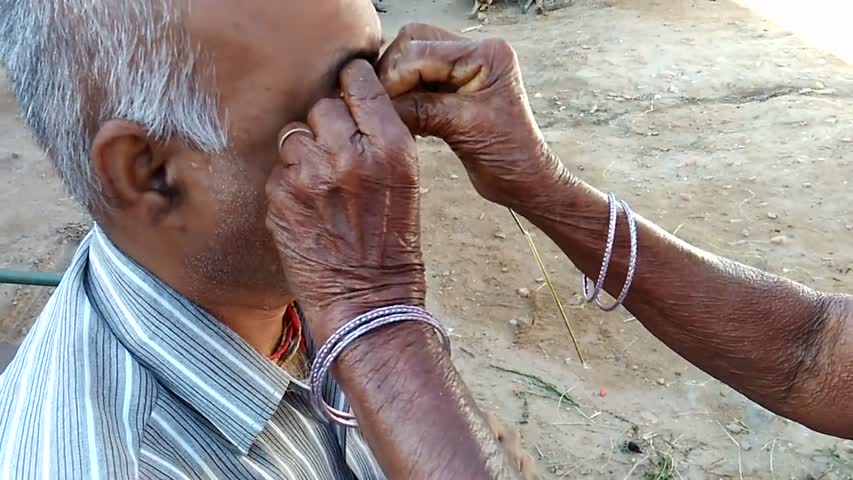 Amazing technique to remove dust and stone from eye
